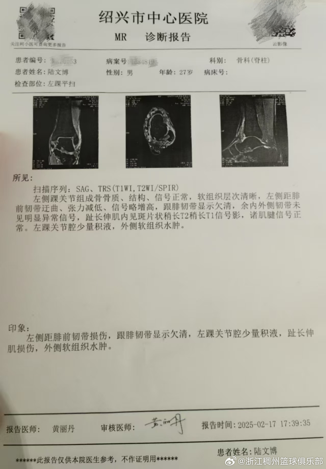 面升级